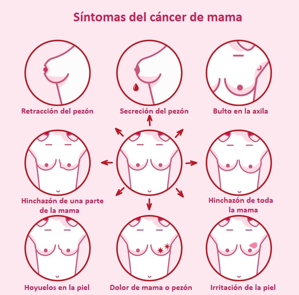 8 síntomas del cáncer de mama