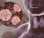 El aumento de casos de cáncer de tiroides, a estudio