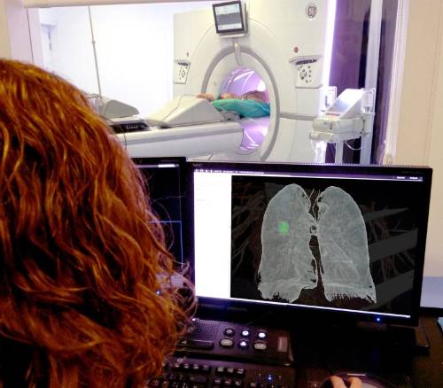 Cribado de cáncer de pulmón mediante tomografía