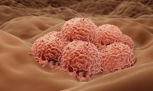 Células del cáncer de piel melanoma