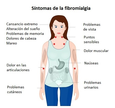 Síntomas de la fibromialgia: cansancio, alteraciones del sueño, dolor muscular y articular, náuseas y problemas urinarios, entre otros