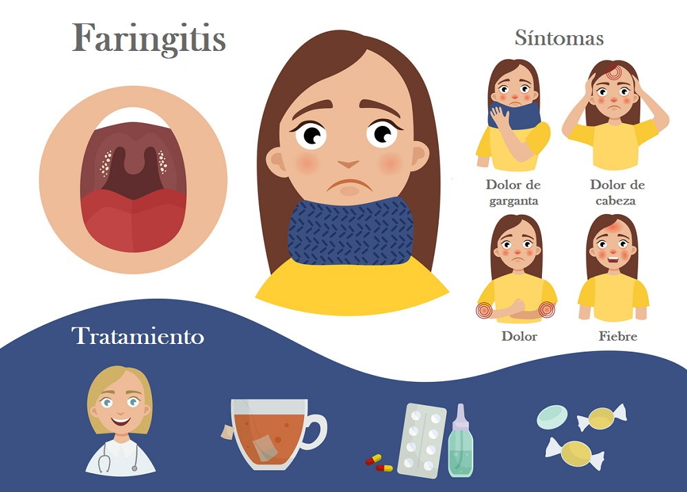 Infografía sobre la faringitis: síntomas y tratamientos