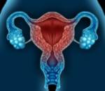 Ospemifeno: tratamiento oral para la atrofia vaginal