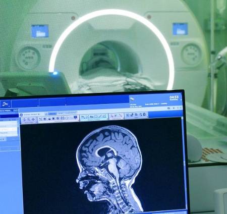 Resonancia magnética y la imagen del cerebro