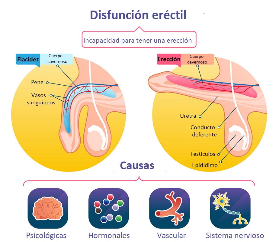 Anatomía del pene y causas de la disfunción eréctil
