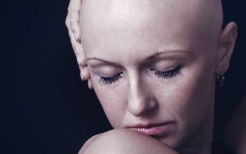 Nueva técnica para dar solución a la alopecia