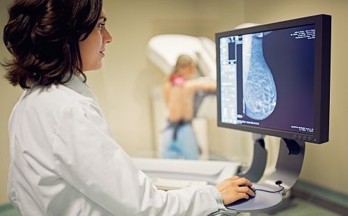 Mamografía para el diagnóstico del cáncer de mama