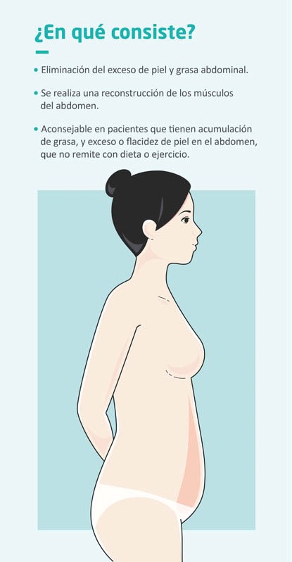 Objetivos de la abdominoplastia