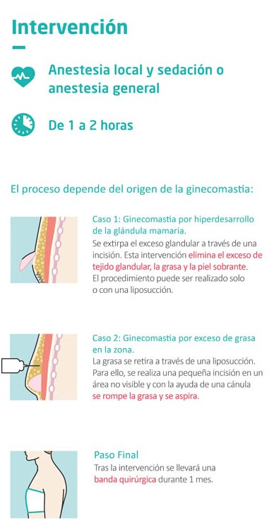 Intervención de la ginecomastia