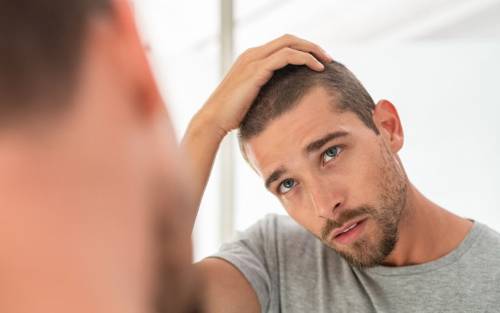 Alopecia y pelo débil tras el confinamiento