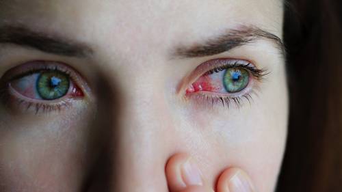 La conjuntivitis alérgica, una pesadilla para los ojos en primavera