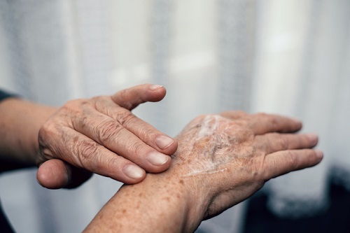 El envejecimiento de las manos